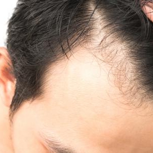 薄毛の人にもリンスは大切!!育毛剤との併用は!?